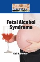 Fetal_alcohol_syndrome